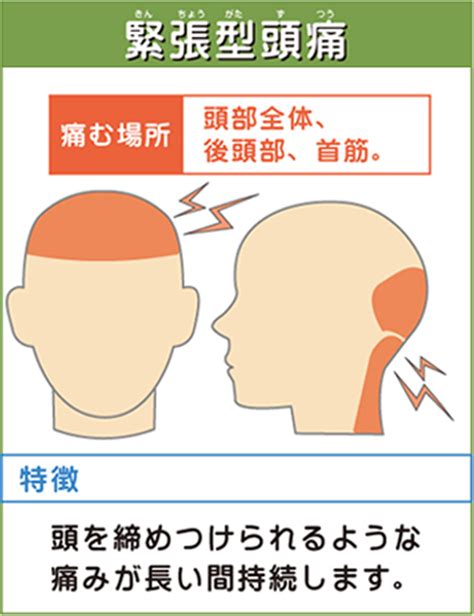 頭痛 解決方法|片頭痛・緊張型頭痛をすぐ治すには？痛みを和らげる。